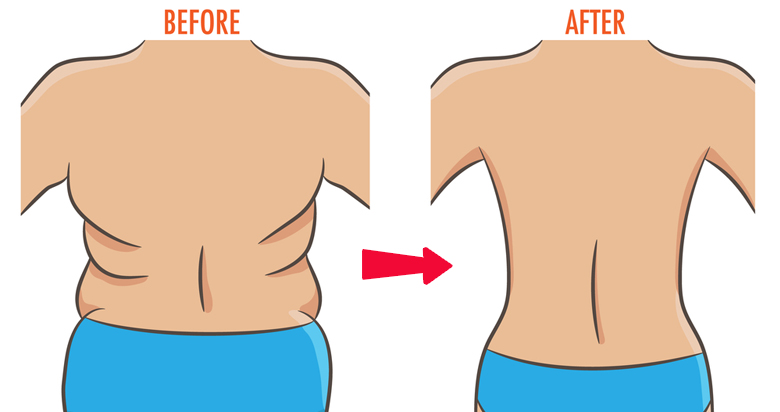 3 Simple Yoga Poses To Get Rid of Belly & Back Fat